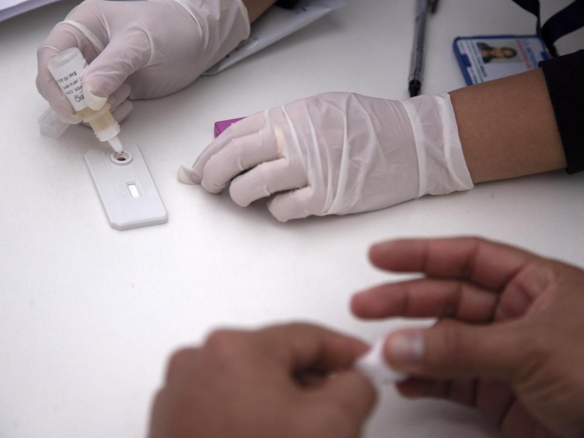 Las jóvenes son las mas afectadas con el virus del sida