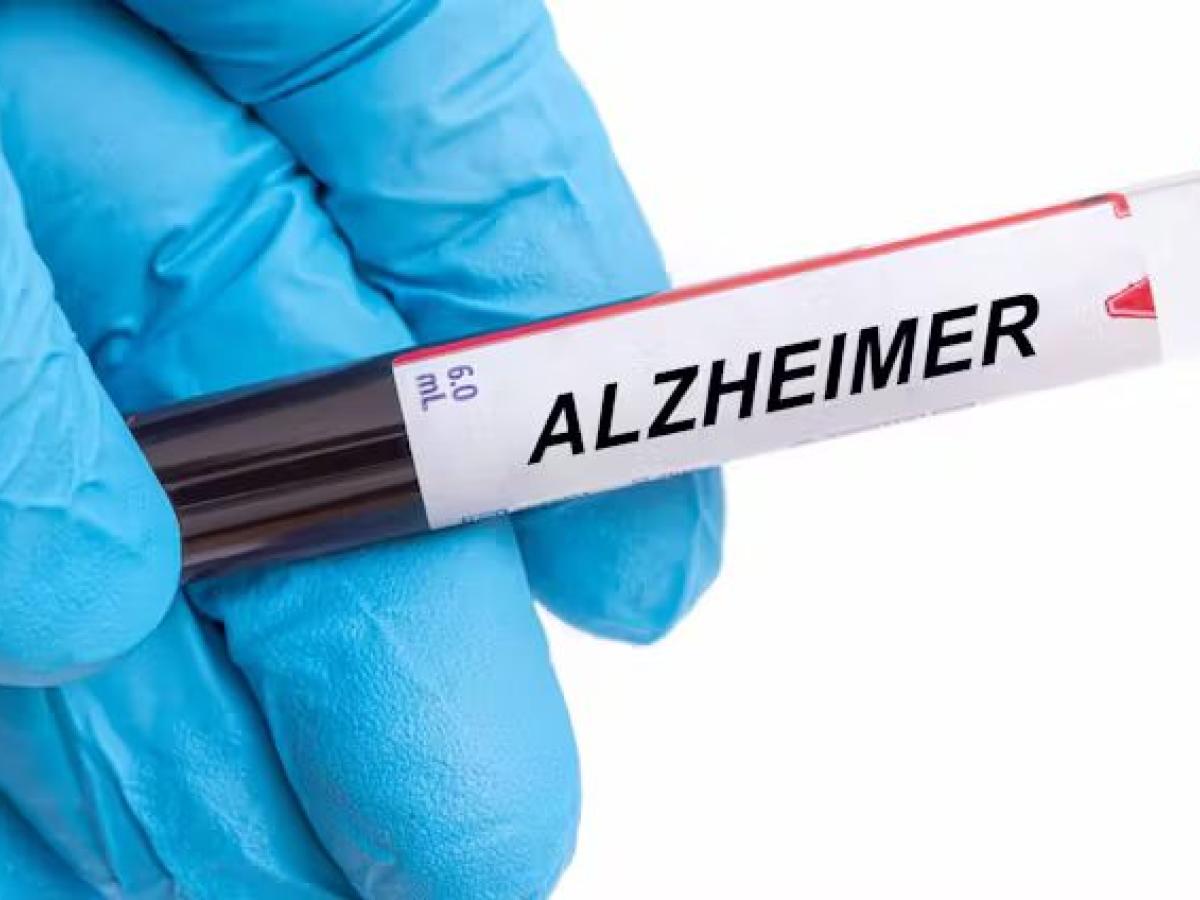 Análisis de sangre para predecir el alzhéimer: comienza una nueva era en la prevención