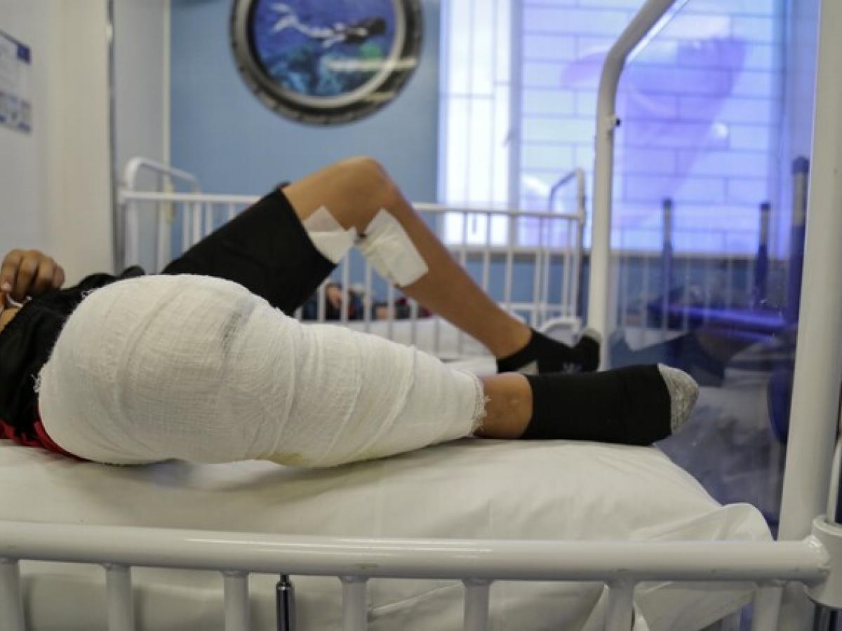 Registran más de 200 menores quemados por pólvora en Colombia