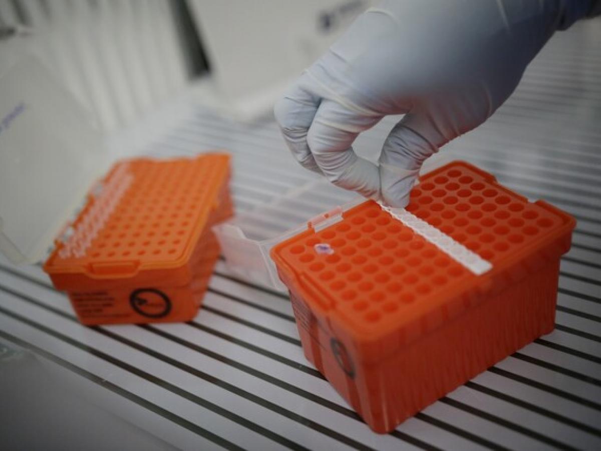 Viruela del mono: INS confirma 15 casos en Colombia