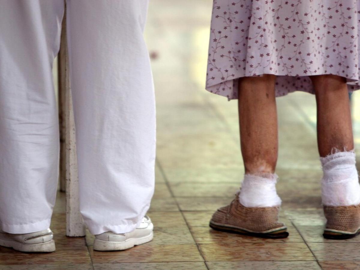 La lepra, una enfermedad milenaria que aún persiste