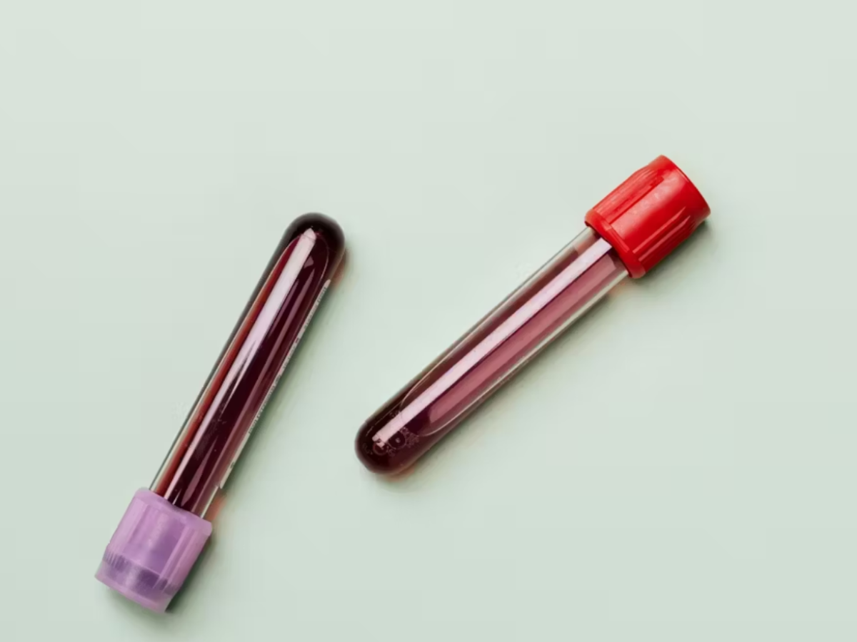 ¿Por qué es importante saber si nuestro grupo sanguíneo es positivo o negativo?