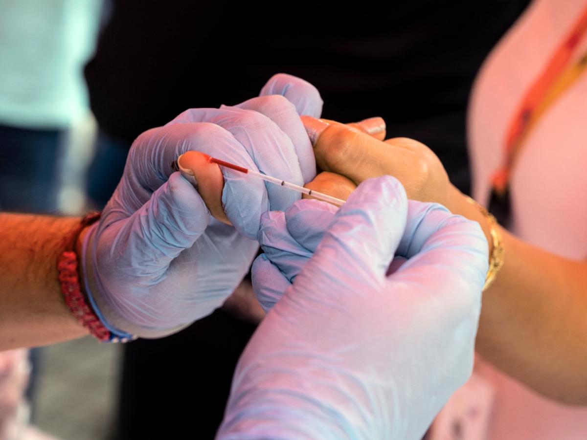 Día Mundial de la lucha contra el Sida 2025: Cifras en Colombia