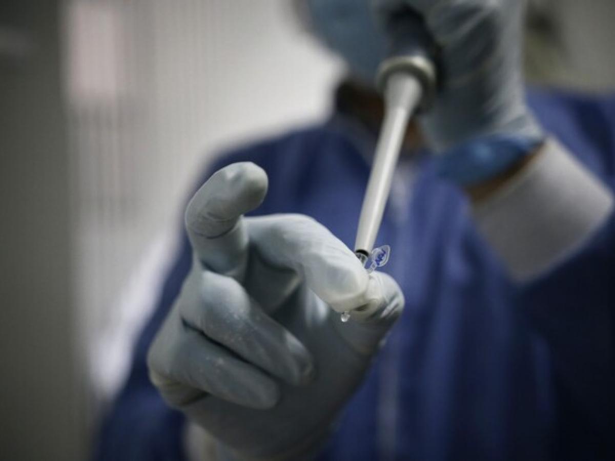 MinSalud pidió a EPS reforzar toma de pruebas PCR para Covid y viruela símica