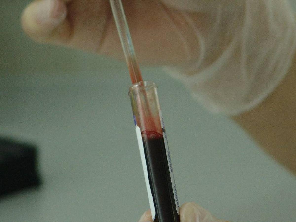 VIH en Risaralda: detección del virus