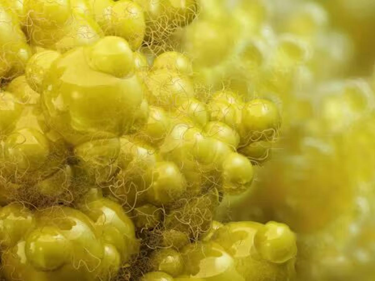 Más allá de la barriga cervecera: el papel oculto de la grasa intermuscular en la salud