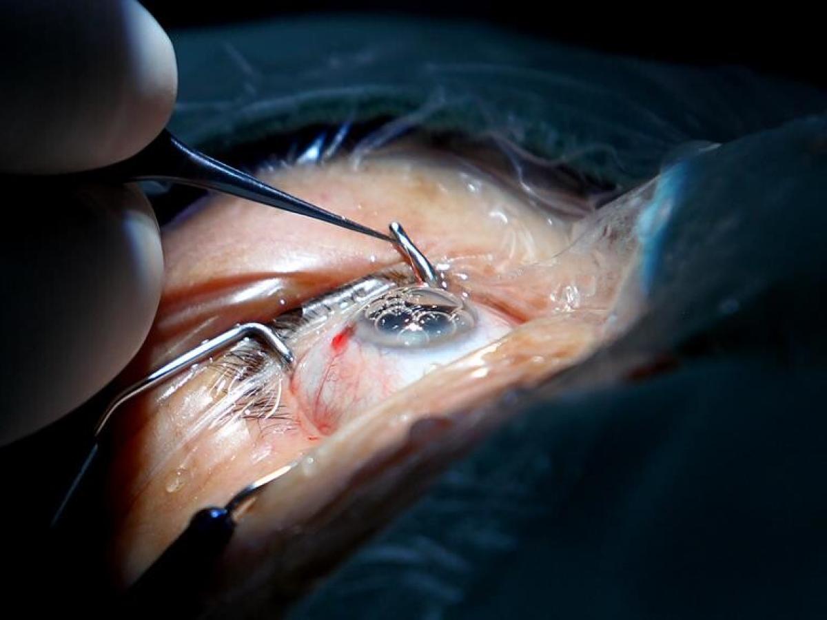 Identifican una fuente potencial de nuevas neuronas para la pérdida de visión