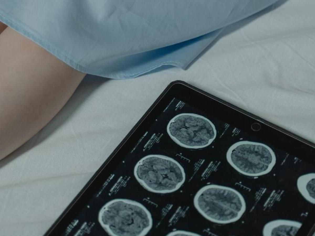 El cáncer afecta cada vez más a los menores de 50 años, como la princesa de Gales