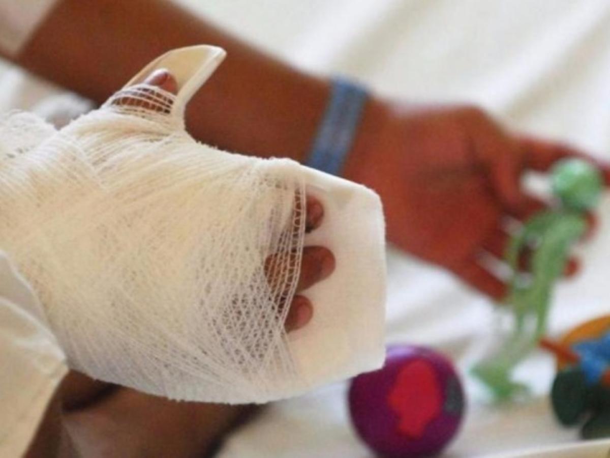 Antioquia: 11 quemados por pólvora en diciembre; Hospital San Vicente alerta