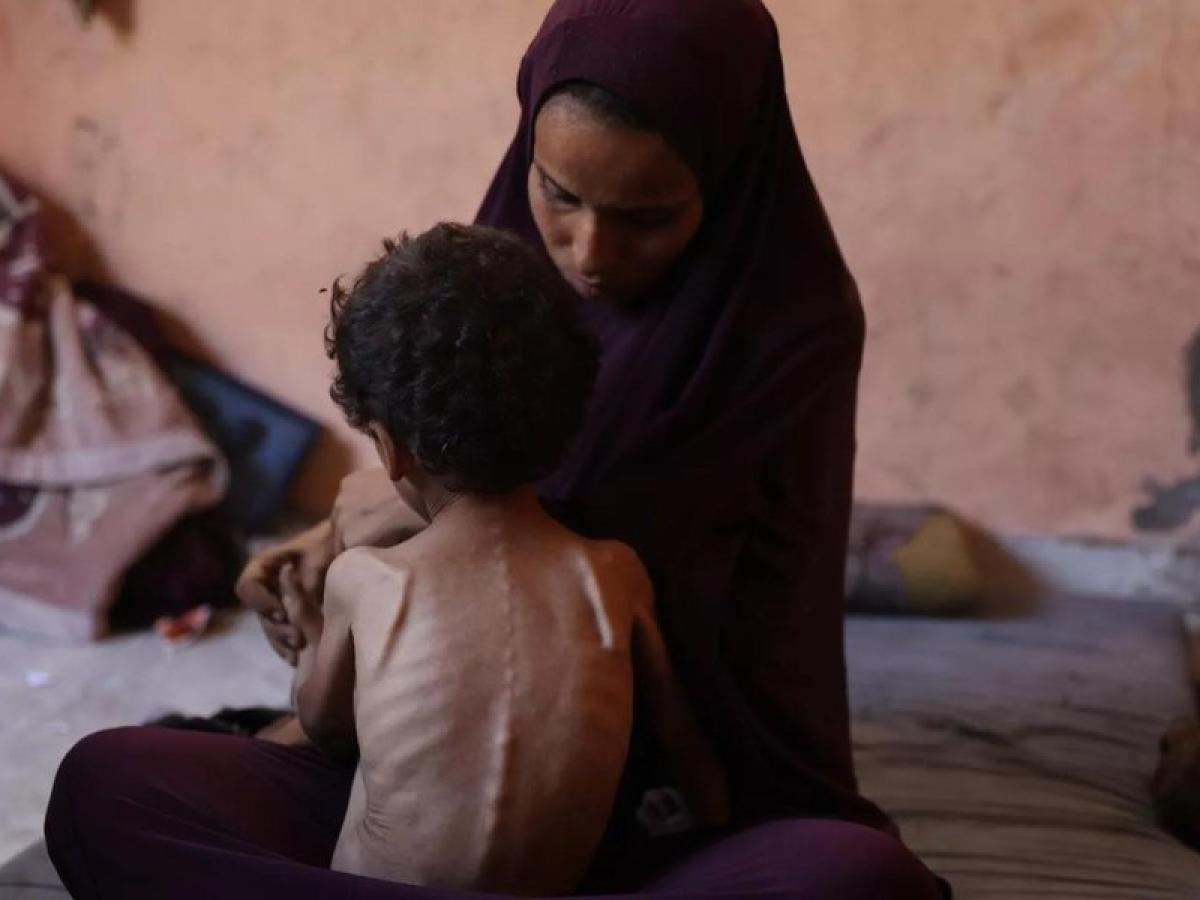 unicef: desnutricion niños gaza