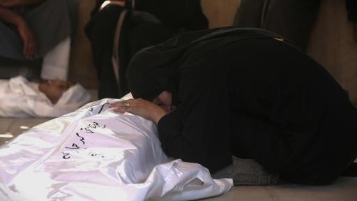 Hospital anunció que 21 niños murieron en Gaza por malnutrición