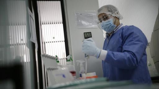 Estos son los 28 para la detención de la viruela símica en Colombia