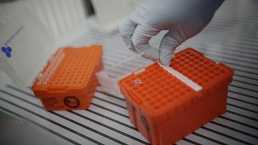 Viruela del mono: INS confirma 15 casos en Colombia