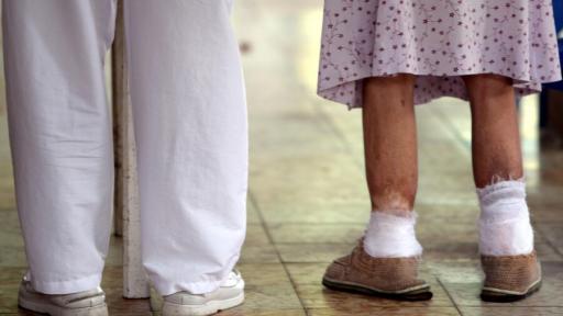 La lepra, una enfermedad milenaria que aún persiste