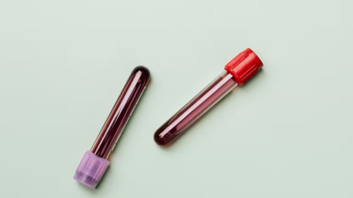 ¿Por qué es importante saber si nuestro grupo sanguíneo es positivo o negativo?