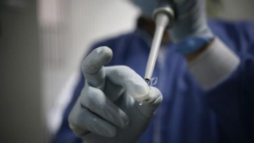 MinSalud pidió a EPS reforzar toma de pruebas PCR para Covid y viruela símica