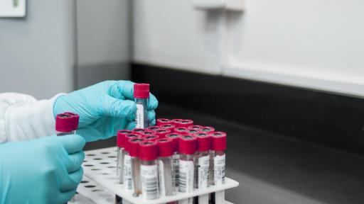 Estado de emergencia por la viruela del mono en EE.UU.