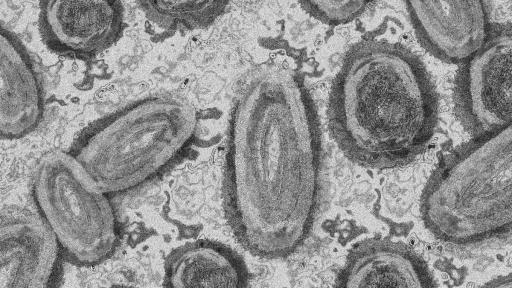 Reportan nuevos casos de la viruela del mono en la Costa Atlántica 