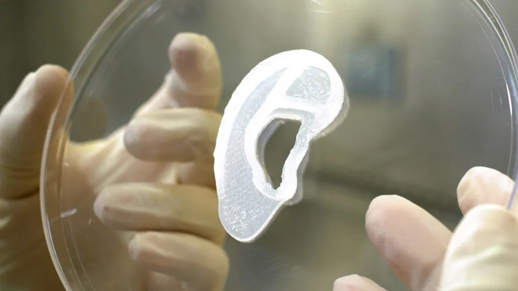 Implantes en el cuerpo 