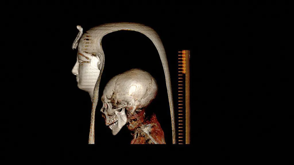 Investigadores egipcios descubren secretos de una momia sin retirarle las vendas