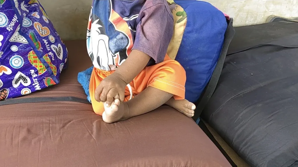 En 2022 han muerto 63 niños por desnutrición en La Guajira