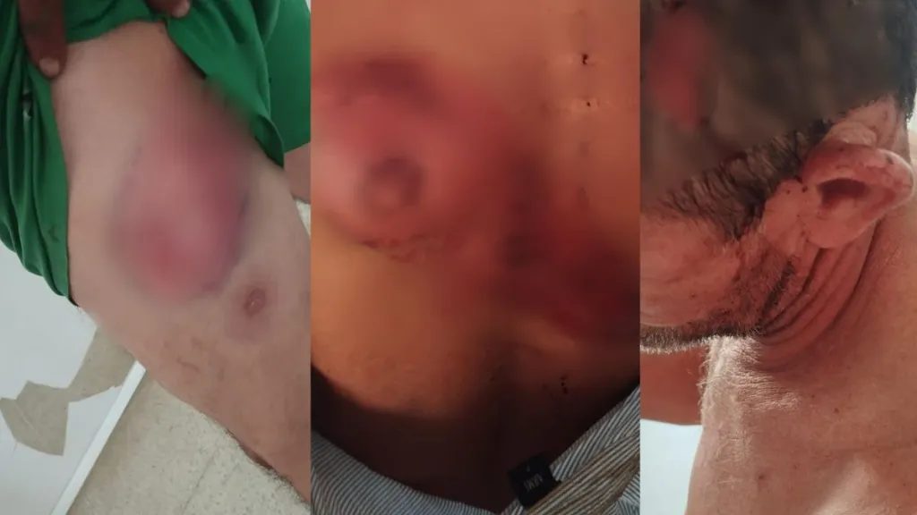 Tortura a campesinos beneficiarios de la ANT en el Meta 