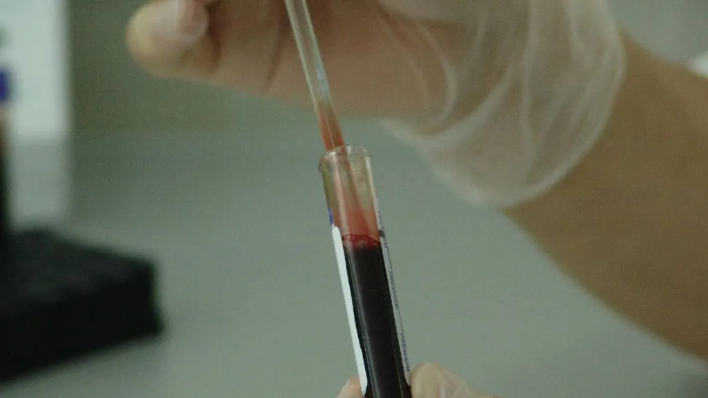VIH en Risaralda: detección del virus