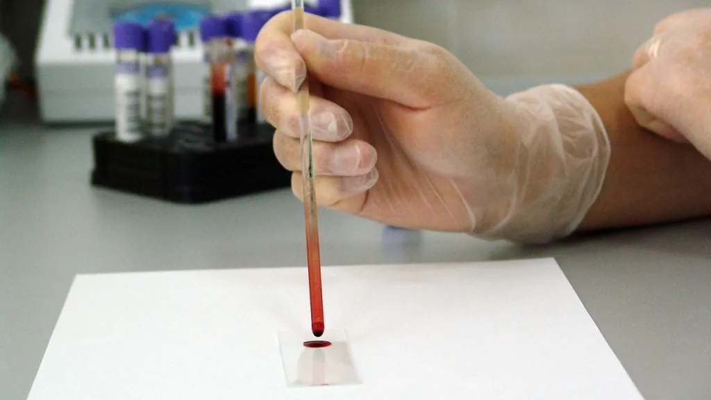 ¿Quién es Elizabeth Holmes, fundadora de Theranos, y por qué está presa?