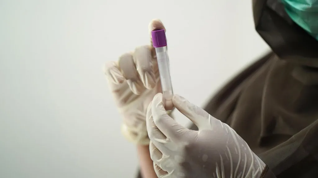 Hepatitis aguda en Colombia: primer caso en Cali