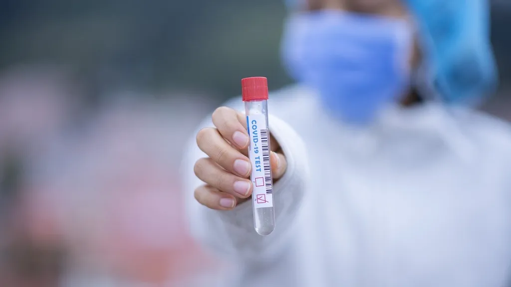 Covid-19 en Colombia: 206 casos nuevos y dos fallecidos