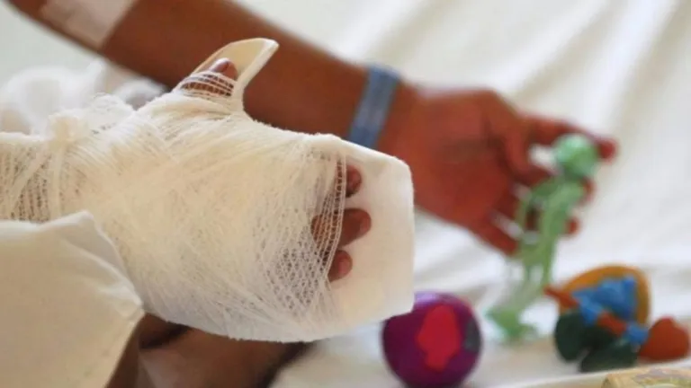 Antioquia: 11 quemados por pólvora en diciembre; Hospital San Vicente alerta