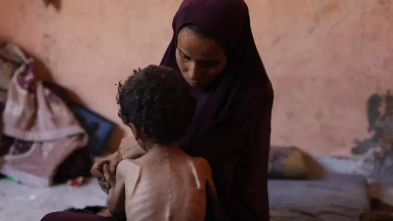unicef: desnutricion niños gaza